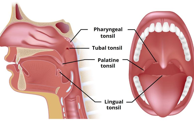 Can Tonsils Grow Back After Being Removed? – Tymoff