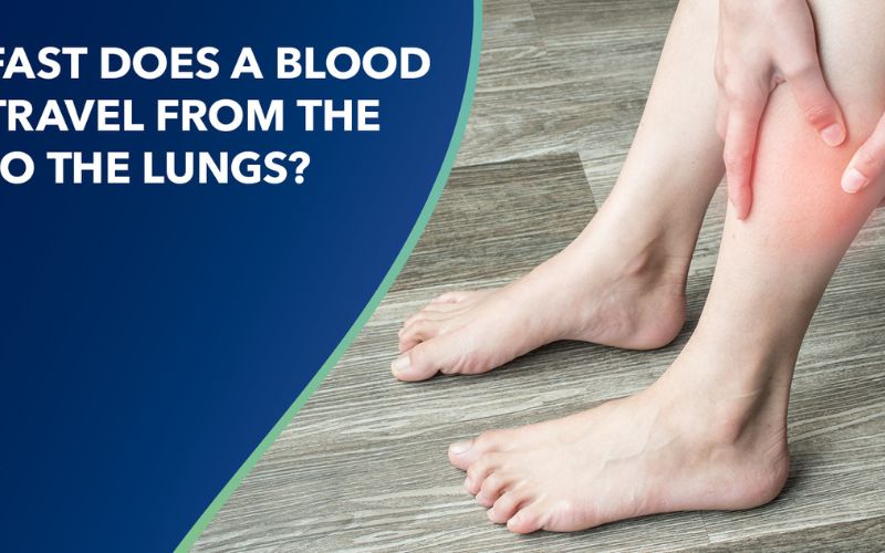 How Fast Does a Blood Clot Travel From the Leg to the Lungs